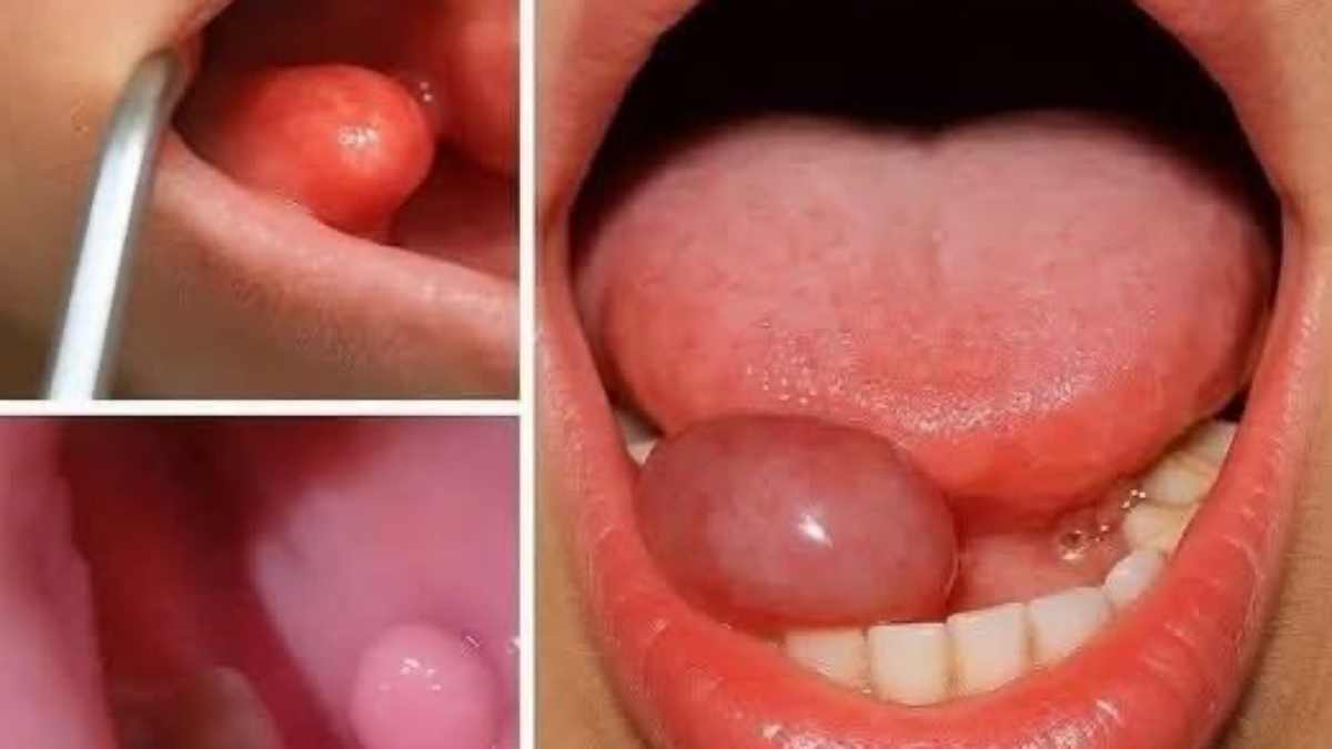 Voici les premiers symptômes de… Voir plus